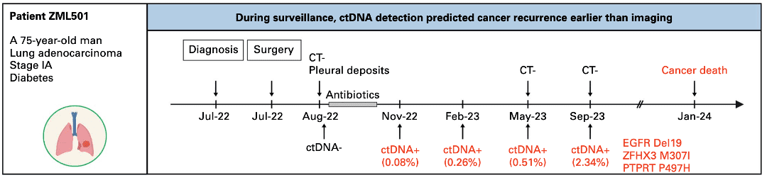 kconnect.genesolutions.com when molecular signals speak first how ctdna monitoring revealed lung cancer recurrence before imaging picture3 1 - The K-CONNECT Platform